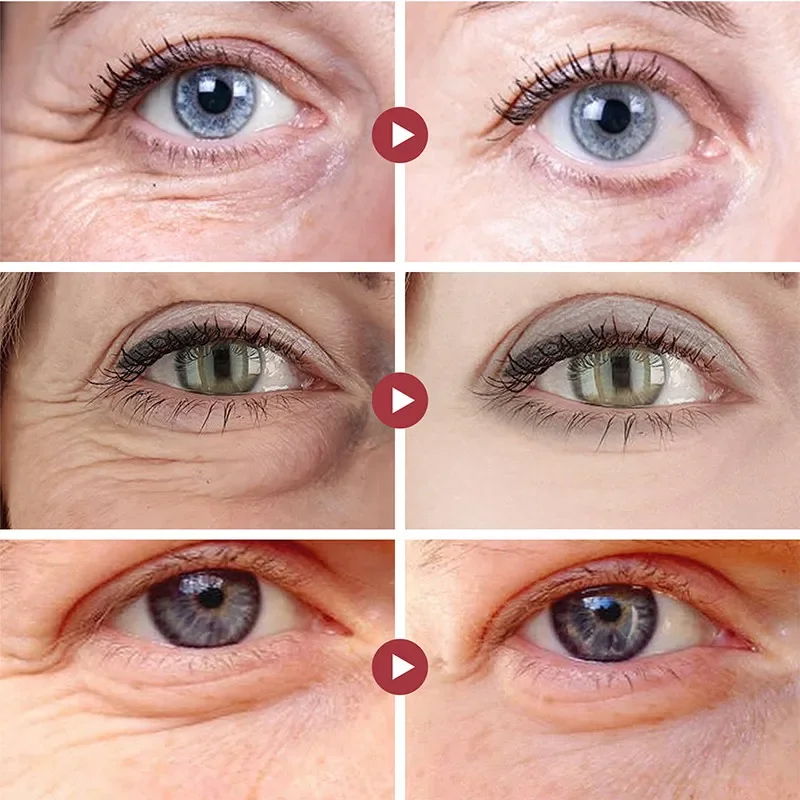 Wrinkle Remove Eyes Patches Fi - Collagen Under Eye Patches 评论和价格