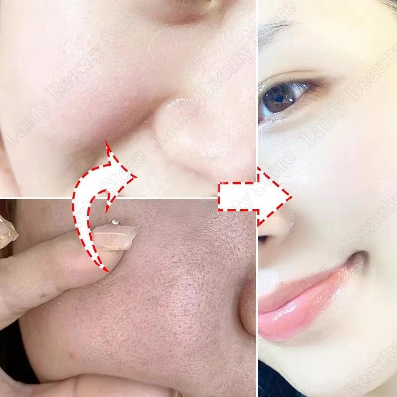 Salicylic Acid Pore Clearing C - Salicylic Acid Blackhead Remover 评论和价格